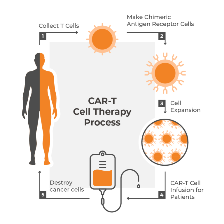 Car T Treatment And How Car T Cell Therapies Work Nanotein